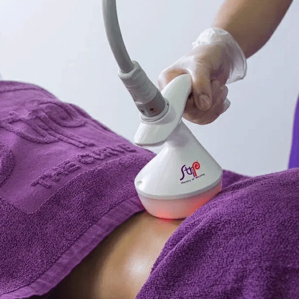 Strip Thermal Shape Body Sculpting