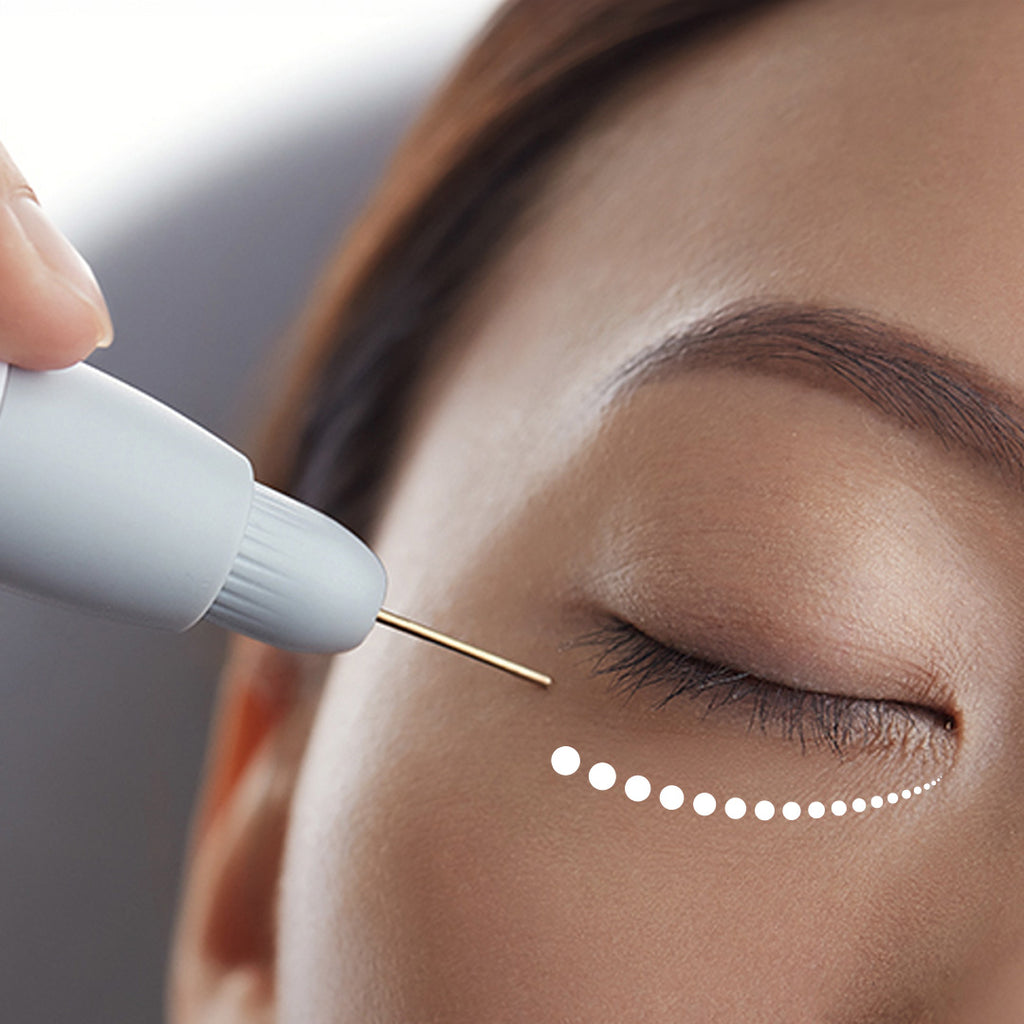 Browhaus Plasma Lift Lower Eyelid Eyelift