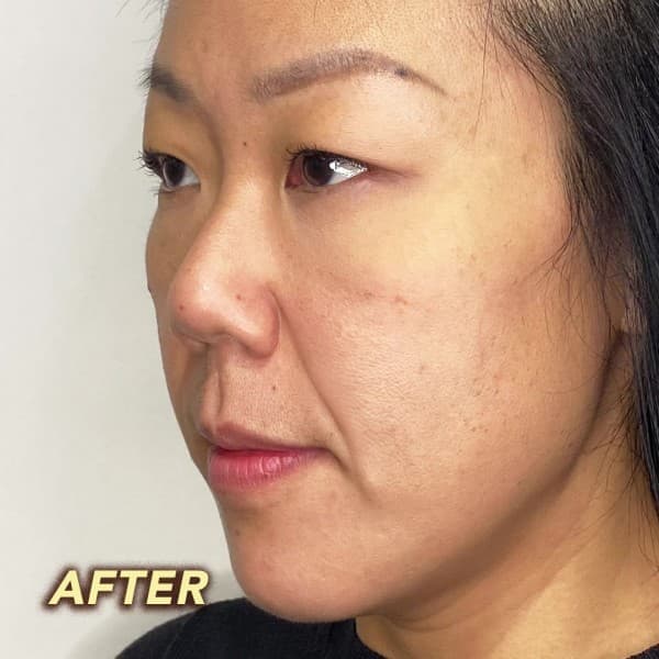 Spa Esprit Gua Sha Facial