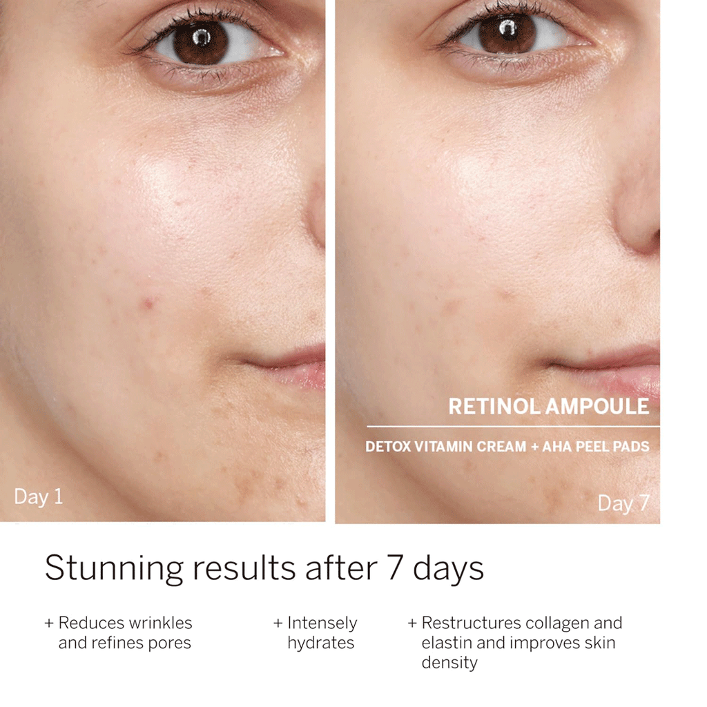 Facial pore refining and wrinkle reduction with Babor Retinol Power Serum