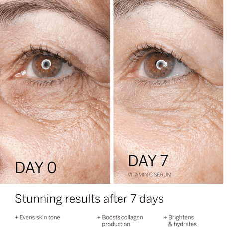Even skin tone, boost collagen production, brighten and hydrate with stunning results in 7 days using Babor Vitamin C